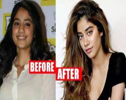 Janhvi Kapoor before surgery